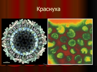 Краснуха – острая вирусная антропонозная инфекция