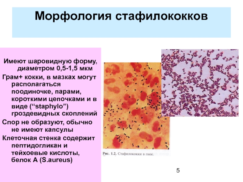 Staphylococcus aureus 10 3