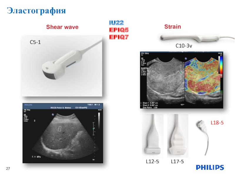 Эластография это. Эластография. Ультразвуковая эластометрия. УЗИ эластография печени. Метод эластографии.