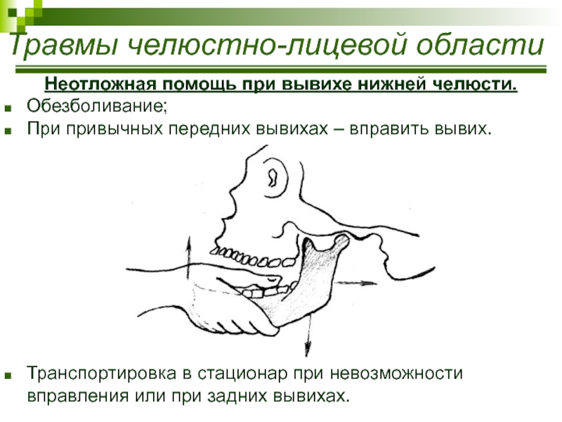 Привычный вывих нижней челюсти карта вызова