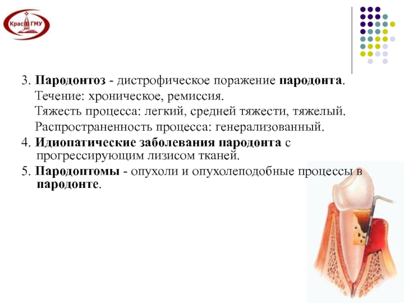 Составление плана лечения пациентов с патологией пародонта воспалительного генеза презентация