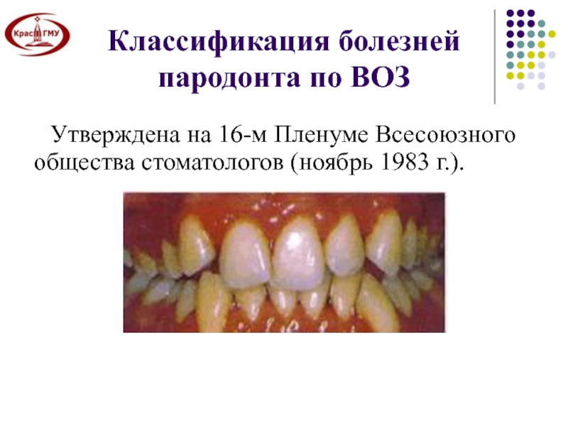 Доклад по теме Клиническая картина и диагностика пародонтоза