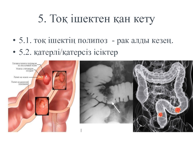 Подпериод кету