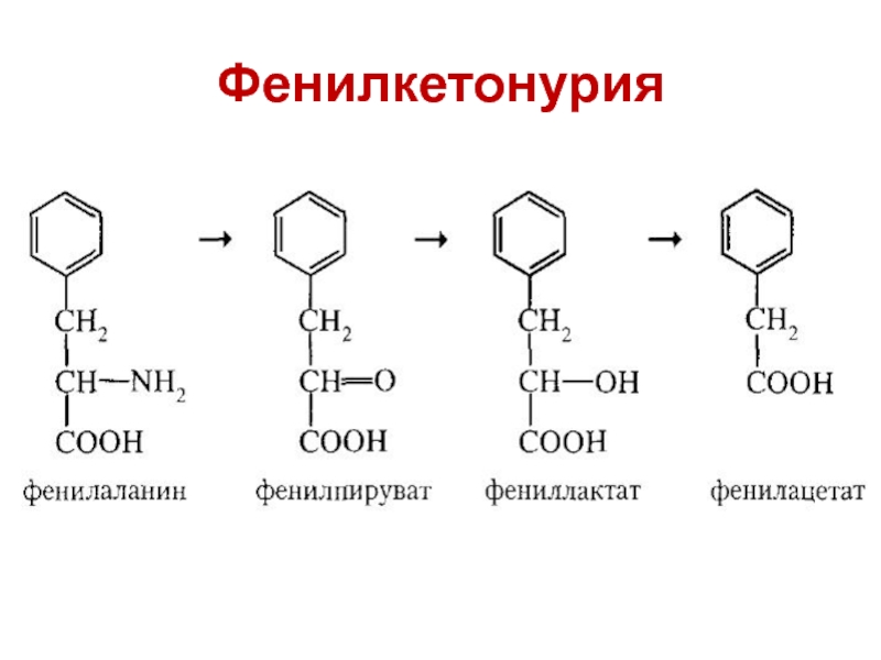Фенилкетонурия фермент. Фенилкетонурия у новорожденных классификация. Фенилкетонурия биохимия.