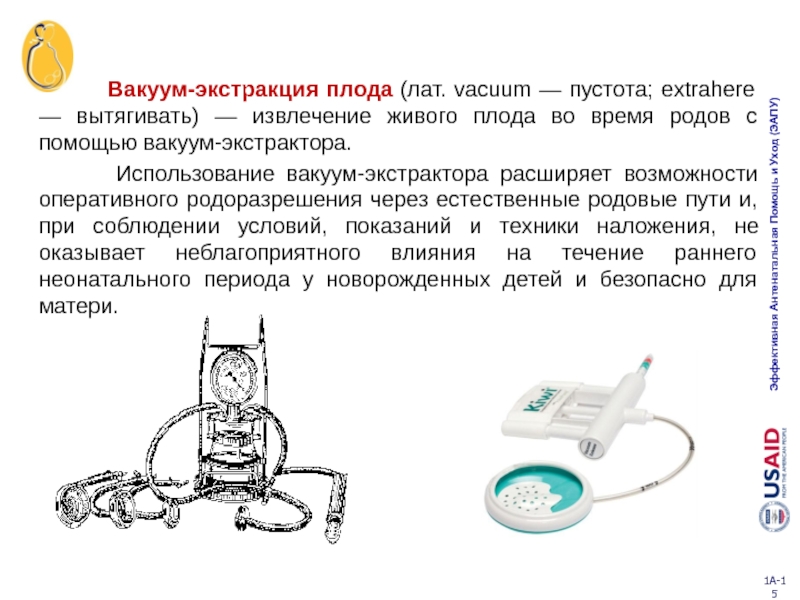 Вакуум экстракция плода презентация