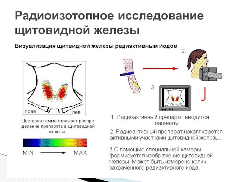 Радиоизотопные методы исследования. Инструментальные методы исследования щитовидной железы. Туберкулез щитовидной железы. Радиоизотопное исследование. Радиоизотопное исследование презентация.