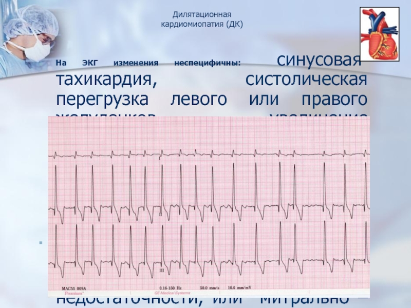 Синусовая тахикардия. ЭКГ при синусовой тахикардии. ЭКГ синусовая тахикардия 12 отведений. Синусовая тахикардия изменения на ЭКГ. Изменения на ЭКГ при синусовой тахикардии.