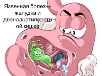 язвенная болезнь