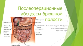 Послеоперационные абсцессы