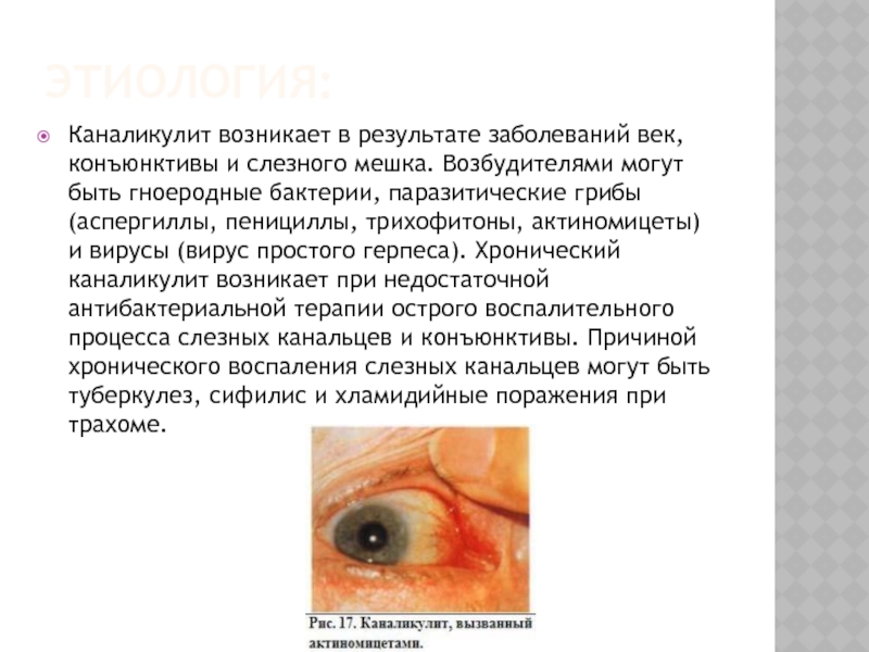 Картинки на тему офтальмология