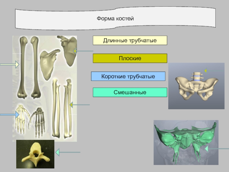 Костя длинный. Формы костей.