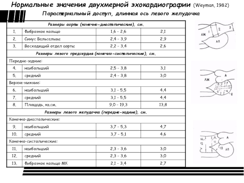 Учебный план эхокардиография