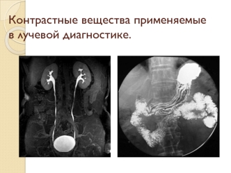 Контрастные вещества, применяемые в лучевой диагностике