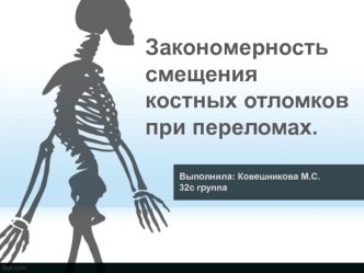 Закономерность смещения костных отломков при переломах