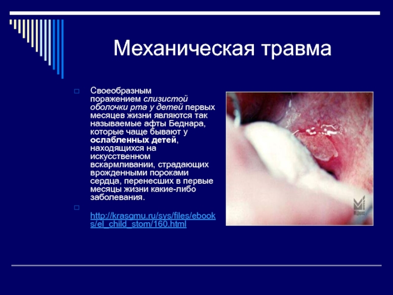 Реферат: Травматические поражения слизистой оболочки рта