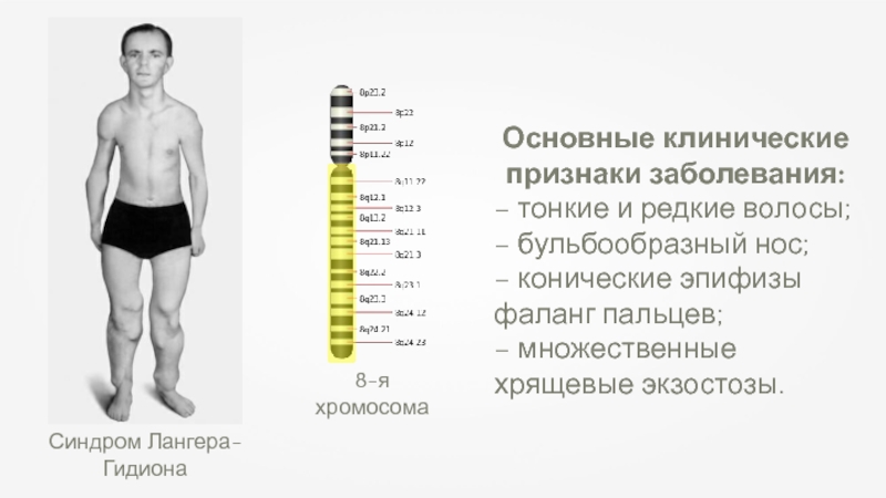 8 хромосома. Синдром Лангера-Гидеона. Синдром лангнра гидимона. Трихоринофалангеальный синдром.