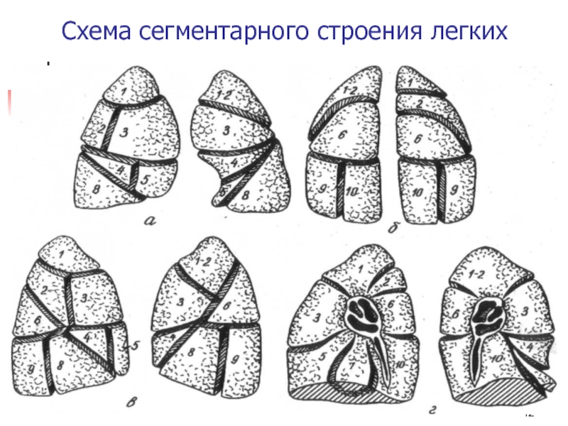 Сегменты легких на схеме