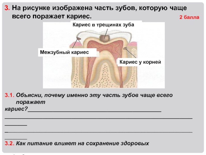Какие части у зуба. Какие зубы чаще всего поражаются кариесом. Какая часть зуба при кариесе чаще поражает. Какие зубы поражаются реже всего кариесом. Какие зоны зуба чаще поражаются кариесом?.
