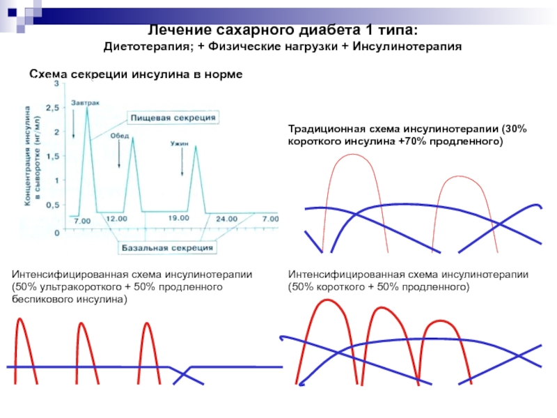 Схема инсулинотерапии при сахарном диабете 1 типа