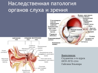 Наследственная патология органов слуха и зрения