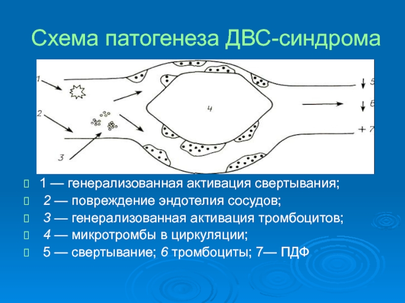 Реферат: Синдром диссеминированного внутрисосудистого свертывания