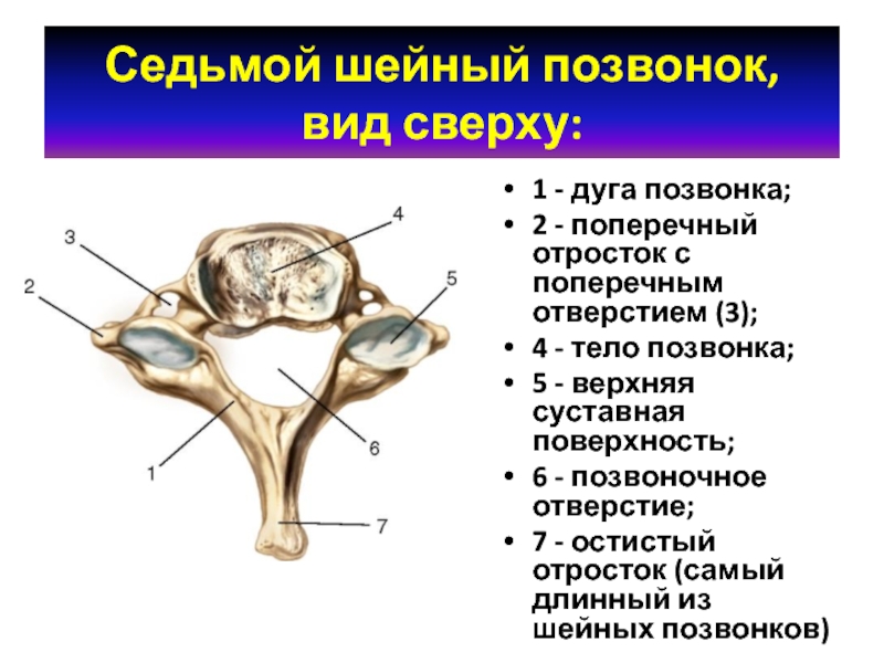 Тело позвонка шейного. Поперечный отросток с7 позвонка. Остистый отросток 7 шейного позвоночника. Остистый отросток седьмого шейного. Седьмой шейный позвонок.