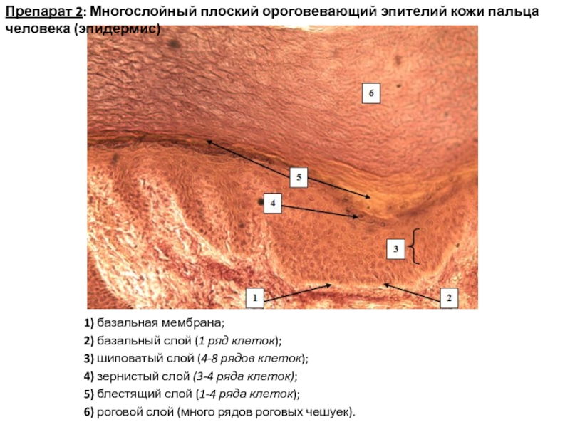 Многослойный плоский ороговевающий эпителий кожи пальца рисунок