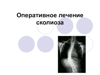 [MedBooks-Медкниги]Оперативное лечение сколиоза