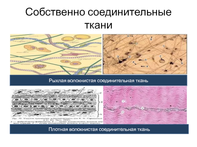 Волокнистая соединительная ткань картинки