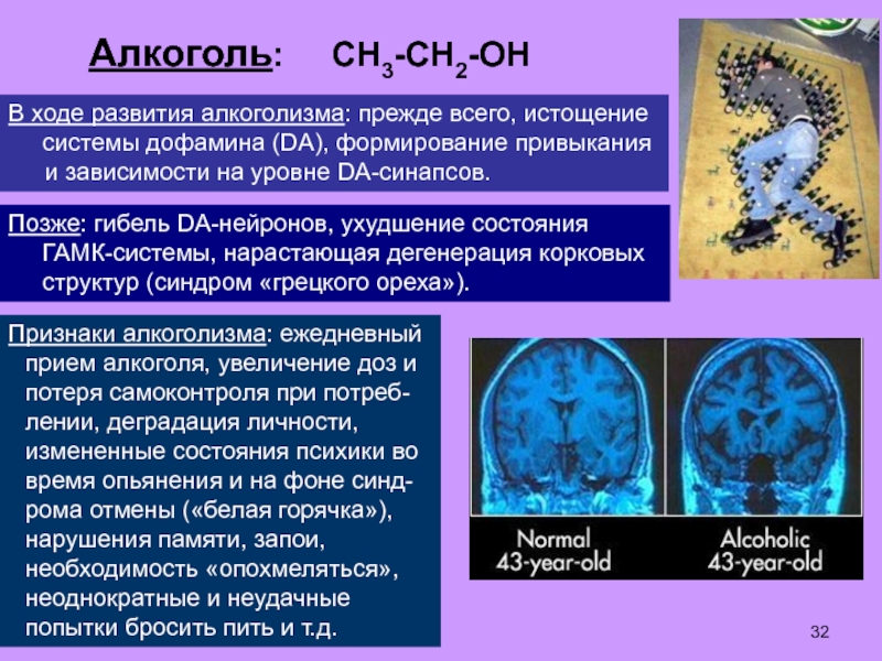 Дегенерация головного. ГАМК И алкоголь. Алкоголь и ГАМК рецепторы. Дегенерация нейронов головного мозга.