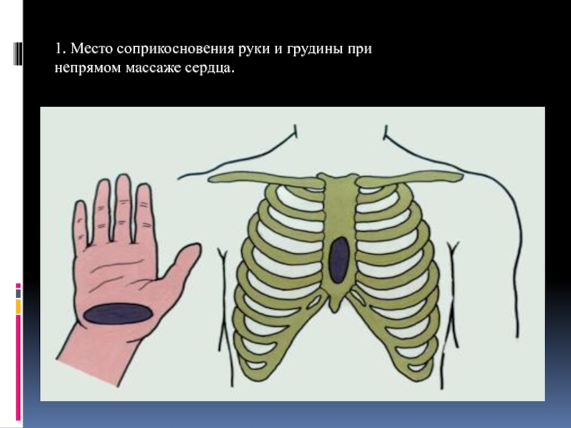 Средняя треть грудины. Место соприкосновения руки и грудины при непрямом массаже сердца. Непрямой массаж сердца место расположения рук на грудной клетке. Место расположения ладоней при непрямом массаже сердца. Местоположение рук при непрямом массаже.