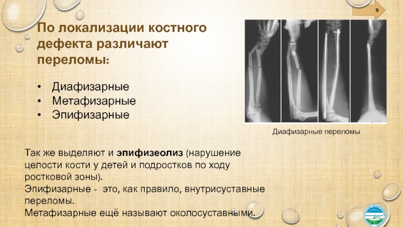 Переломы и вывихи общая хирургия презентация