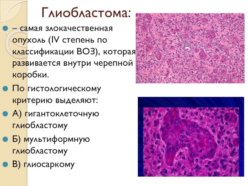 Глиобластома почему толстеют