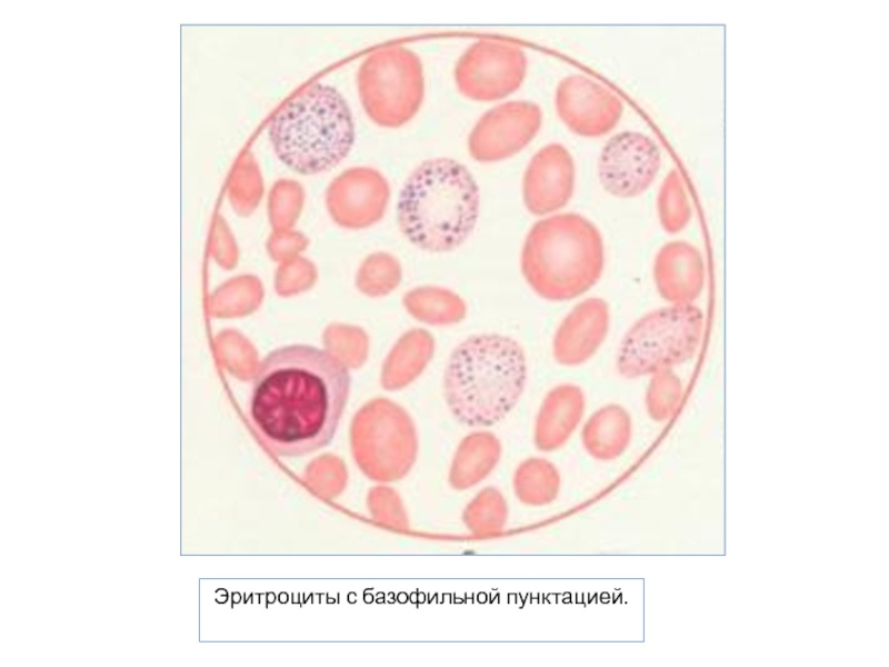 Базофильная пунктация эритроцитов фото