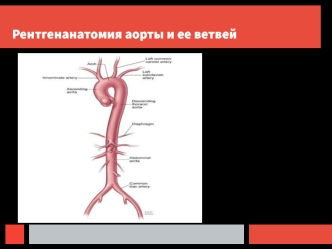 Рентгенанатомия аорты и ее ветвей