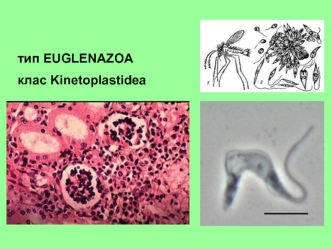 Кинетопластиды. Види паразитичных джгутиконосцев