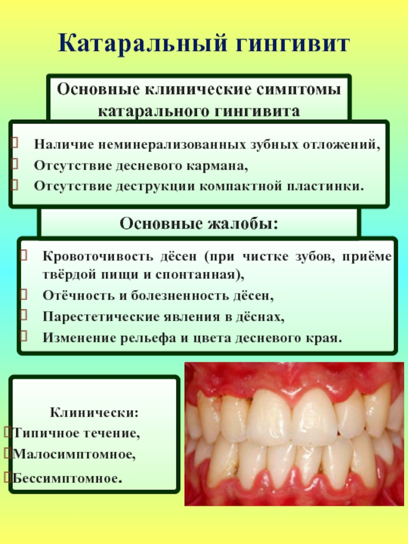 Признаки лечения зубов. Острый каратальный гингигивит. Некротический гингивит Венсана. Катаральное воспаление десен.