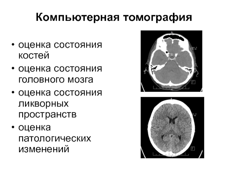 Диагноз головного мозга