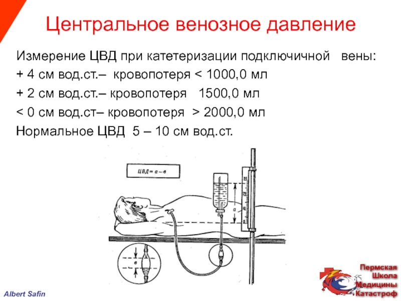 Давление 1000. Измерение ЦВД аппаратом Вальдмана. Измерение центрального венозного давления алгоритм. Нормальные показатели центрального венозного давления. Методика измерения ЦВД алгоритм.