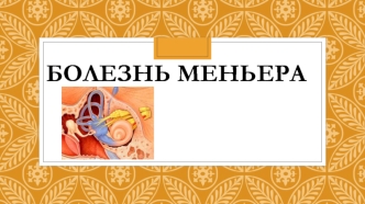 Болезнь Меньера. Классификация болезни Меньера