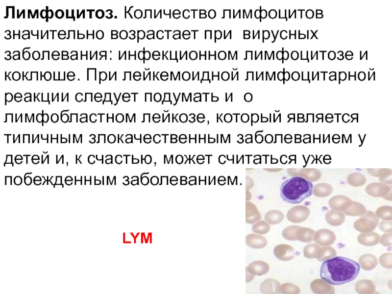 Лимфоциты антибиотики. Лимфоцитоз патогенез. Лимфоцитоз при вирусной инфекции у детей. Лимфоцитоз при бактериальной инфекции. Механизм развития лимфоцитоза.