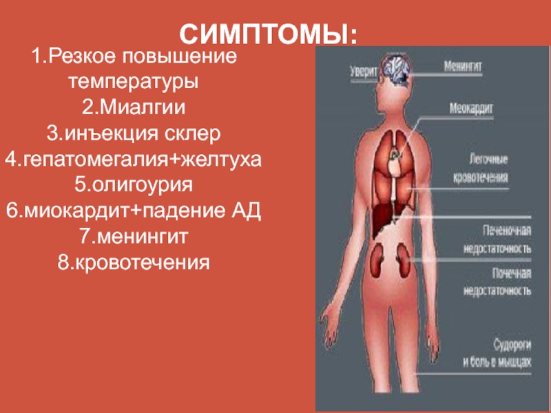 Миалгия симптомы. Миалгия симптомы причины возникновения и симптомы. Эпидемическая миалгия симптомы. Миалгия симптомы у женщин.