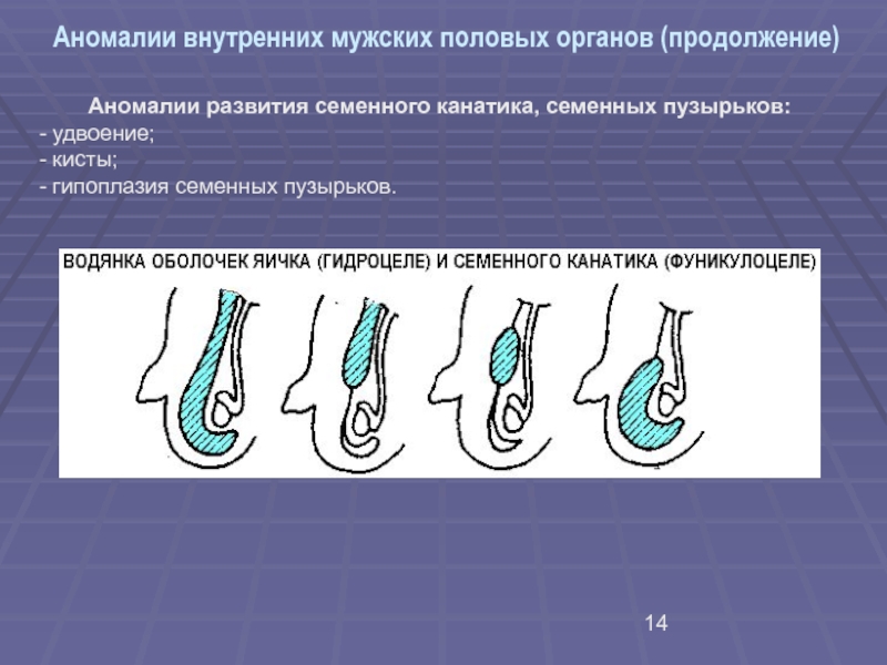 Аномалии развития яичников презентация