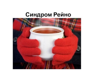 Синдром Рейно