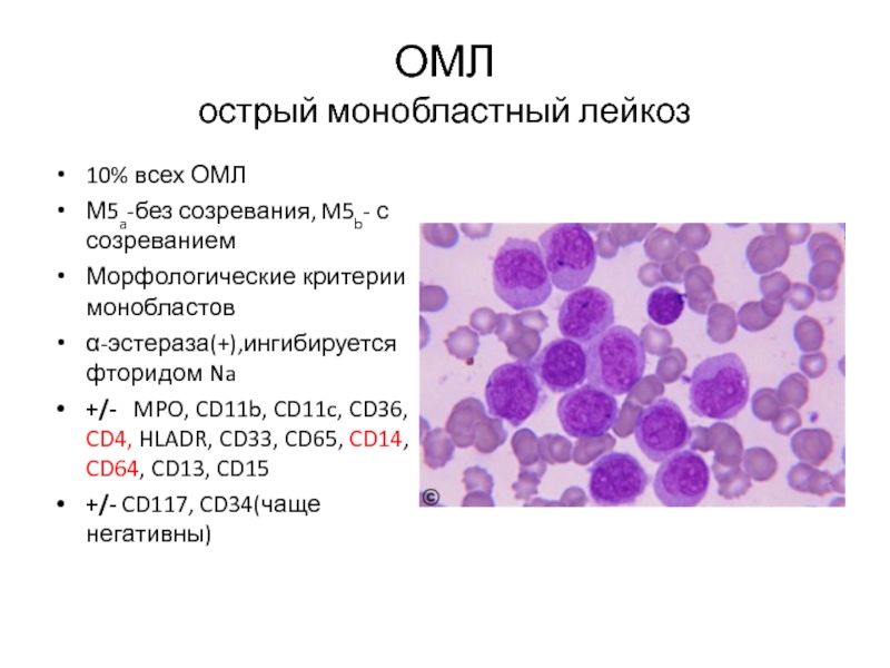 Картина крови острого лейкоза