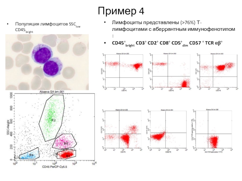 Схема подсчета лимфоцитов разных популяций с помощью проточного цитофлюориметра иммунология