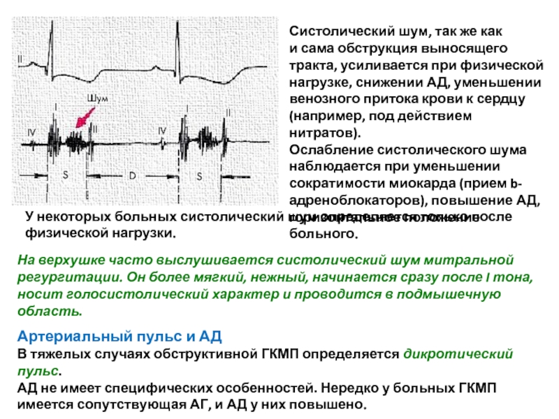 Шум на вдохе. Характеристика функционального систолического шума. Систолический шум на аорте характерен для:. Функциональный систолический шум при анемии механизм. Классификация систолических шум в сердце.
