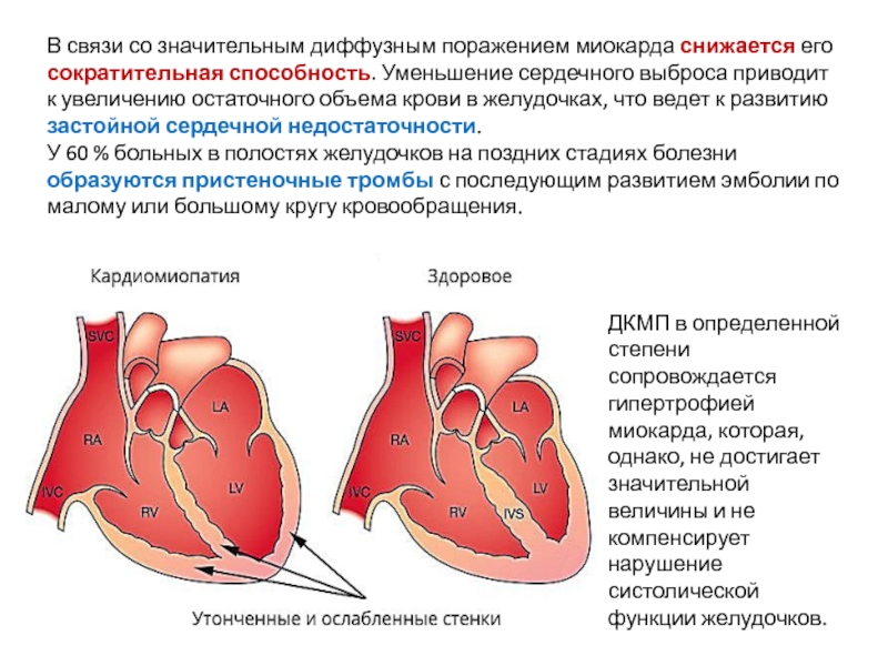 Давление правого предсердия. Диффузное снижение сократительной способности миокарда. Уменьшение объема левого желудочка сердца. Снижение сердечного выброса. Снижение сократительной способности сердца.