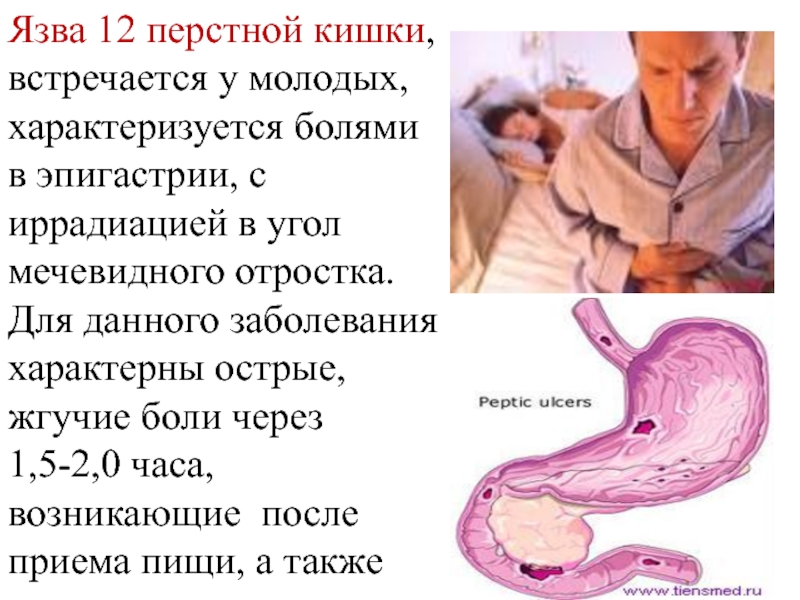 Острая боль 12 перстной кишки. Для язвенной болезни 12-перстной кишки характерны боли:. Язва 12ти перстной кишки. Язвенная болезнь 12 перстной кишки боли.