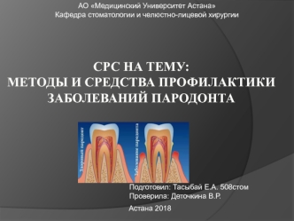 Методы и средства профилактики заболеваний пародонта